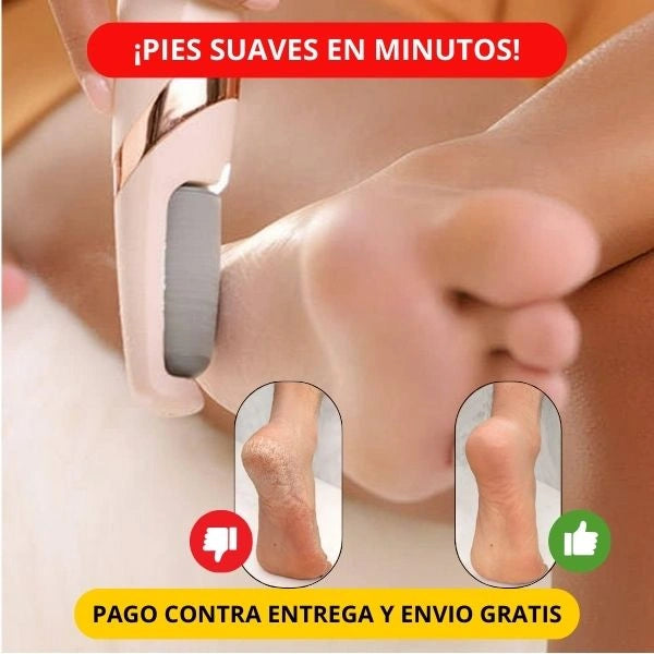 REMOVEDOR DE CALLOS (2 UNIDADES)